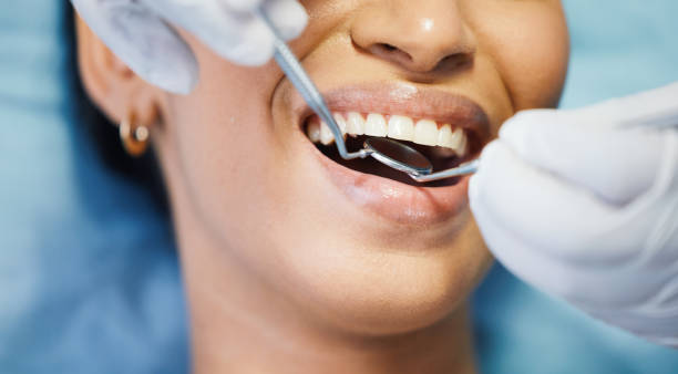 Best Knocked-Out Tooth Emergency  in Rio Vista, CA